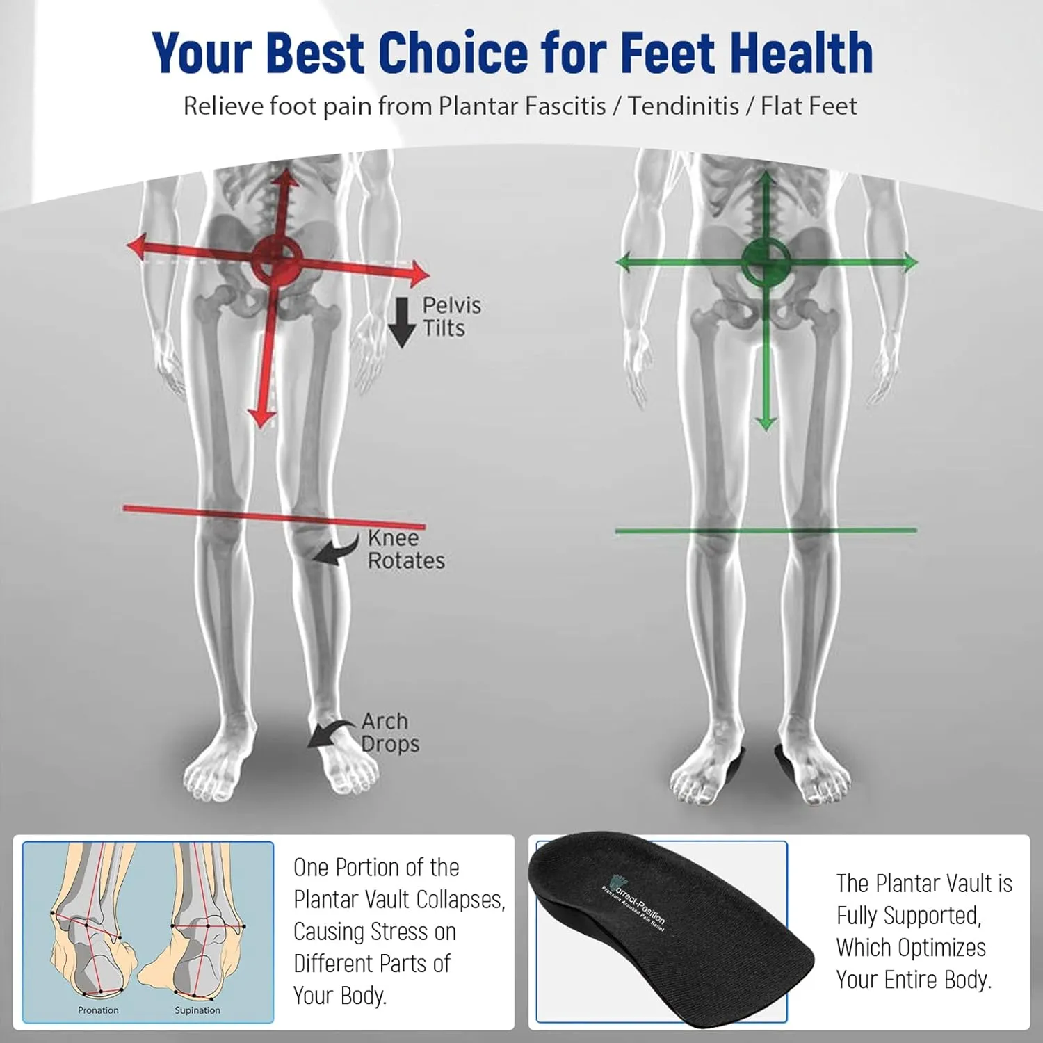 Plantar Fasciitis Relief Arch Support Shoe Inserts for Women and Men, Heel Cup for Heel Pain Relief, Achilles Tendonitis Relief and Max Anti-Shock, Heel Pads for Heel Spur Relief and Heel Lift